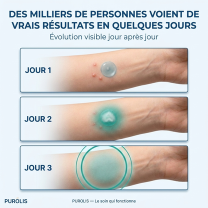 PUROLIS — Patch Hydrocolloïde Molluscum