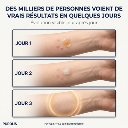 PUROLIS — Patch Hydrocolloïde Molluscum